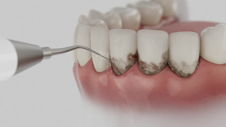 Reliable Dental Implants contractor in West Islip, NY by Smile Center Dentistry